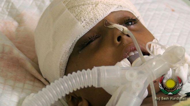 asma face of war